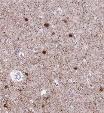 AMMECR1 Antibody - BSA Free