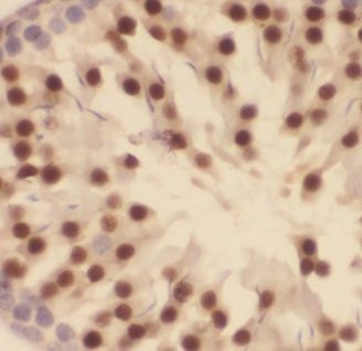 ALS2CR8 Antibody - BSA Free