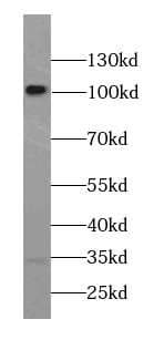 Catenin alpha 2 Antibody - BSA Free