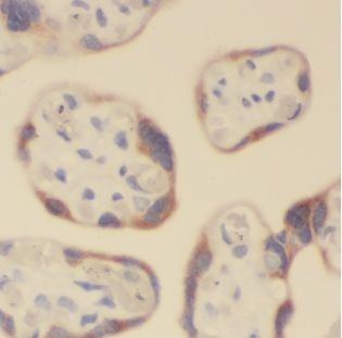 ALG5 Antibody - BSA Free