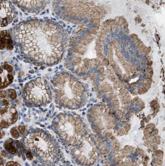ALG13 Antibody - BSA Free