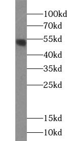 ALDH8A1 Antibody - BSA Free
