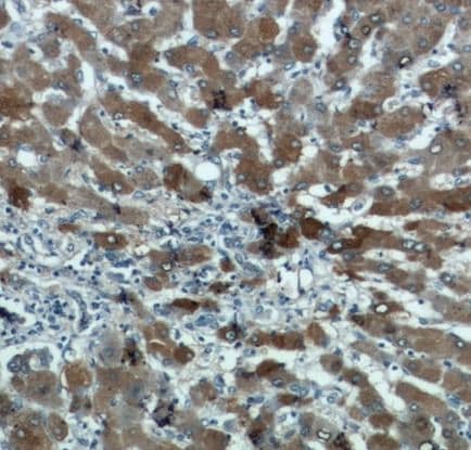 ALDH8A1 Antibody - BSA Free