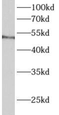 ALDH3B1 Antibody - BSA Free
