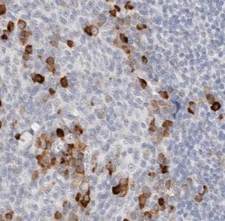 AKNA Antibody - BSA Free