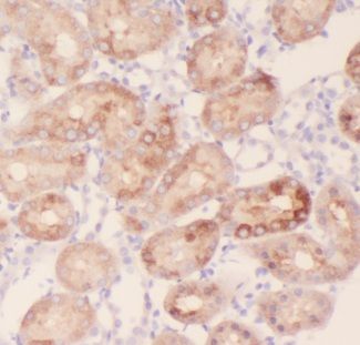 AKAP14 Antibody - BSA Free