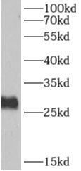 AKAP14 Antibody - BSA Free