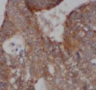 AKAP1 Antibody - BSA Free