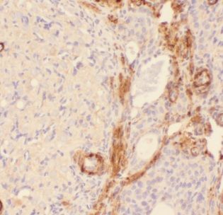 AIG1 Antibody - BSA Free