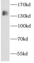 AHI1 Antibody - BSA Free