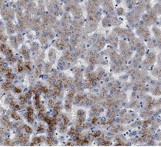 AGXT Antibody - BSA Free