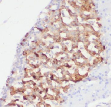 AGTRAP Antibody - BSA Free