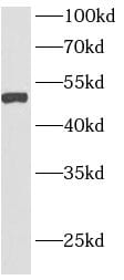AGPAT6 Antibody - BSA Free