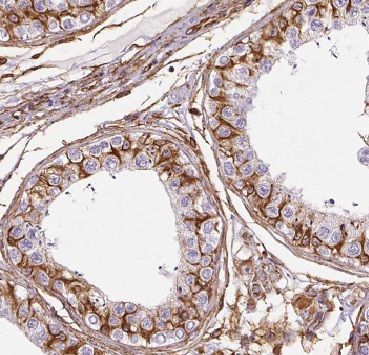 AGPAT6 Antibody - BSA Free