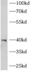 AGPAT3 Antibody - BSA Free