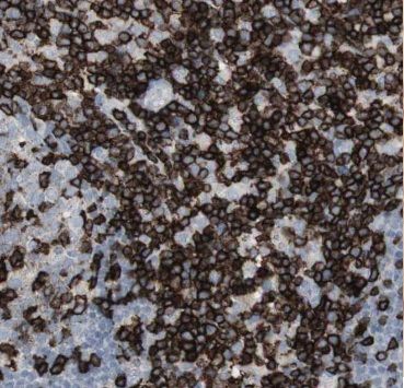 AGFG2 Antibody - BSA Free