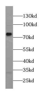 AGBL5 Antibody - BSA Free