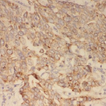 CBCP3 Antibody - BSA Free