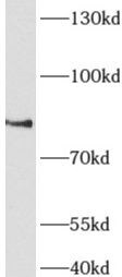 AFAP1L1 Antibody - BSA Free