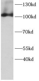 Advillin Antibody - BSA Free