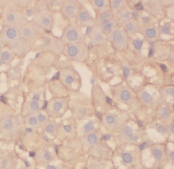 ADPGK Antibody - BSA Free