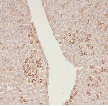 ADHFE1 Antibody - BSA Free
