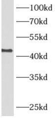 alcohol dehydrogenase 7 Antibody - BSA Free