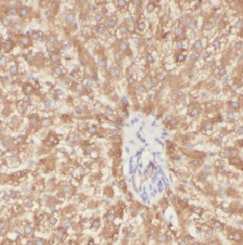 alcohol dehydrogenase 7 Antibody - BSA Free