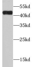 alcohol dehydrogenase 1C Antibody - BSA Free