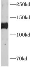 Adenylate Cyclase 6 Antibody - BSA Free