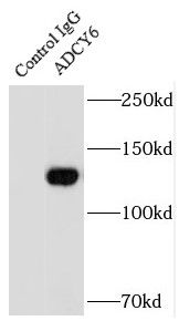Adenylate Cyclase 6 Antibody - BSA Free