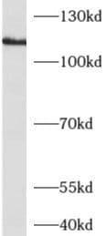 Adenylate Cyclase 1 Antibody - BSA Free