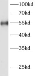 ADAT1 Antibody - BSA Free