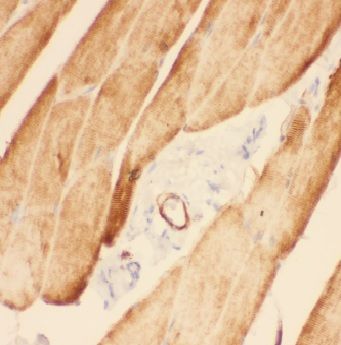 ADAMTSL4 Antibody - BSA Free