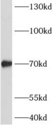 ADAMTSL4 Antibody - BSA Free