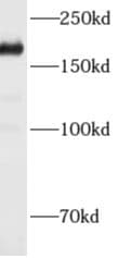ADAMTS12 Antibody - BSA Free