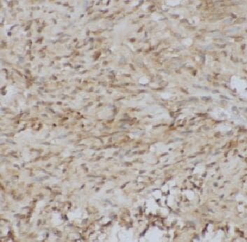 ADAMTS12 Antibody - BSA Free