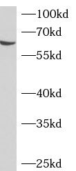 ADAD2 Antibody - BSA Free