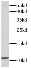 ACYP2 Antibody - BSA Free