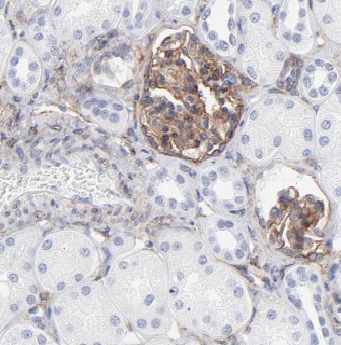 ACYP2 Antibody - BSA Free