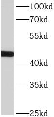 ACTL7B Antibody - BSA Free