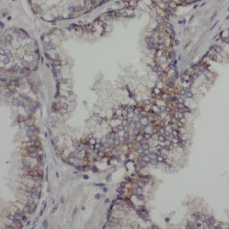 ACTL7B Antibody - BSA Free