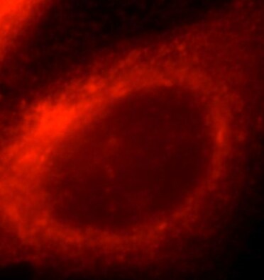 ACSM3 Antibody - BSA Free