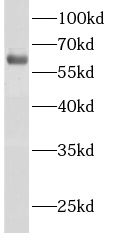 ACSM2A Antibody - BSA Free