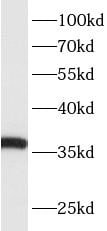 ACPT Antibody - BSA Free