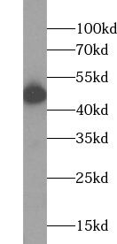 ACP2 Antibody - BSA Free