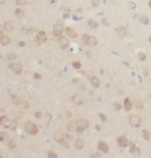 ACOT7 Antibody - BSA Free