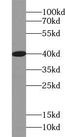 ACOT7 Antibody - BSA Free