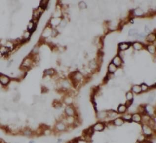 ACOT6 Antibody - BSA Free