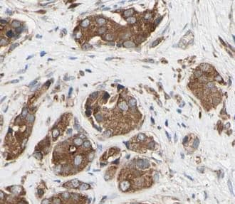 ACOT11 Antibody - BSA Free